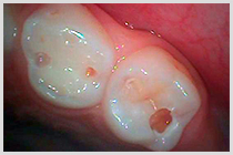 一般歯科・予防歯科